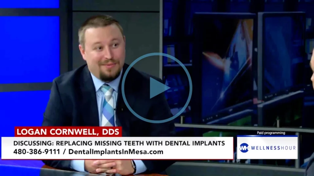 Dr. Logan Cornwell discusses replacing missing teeth with dental implants